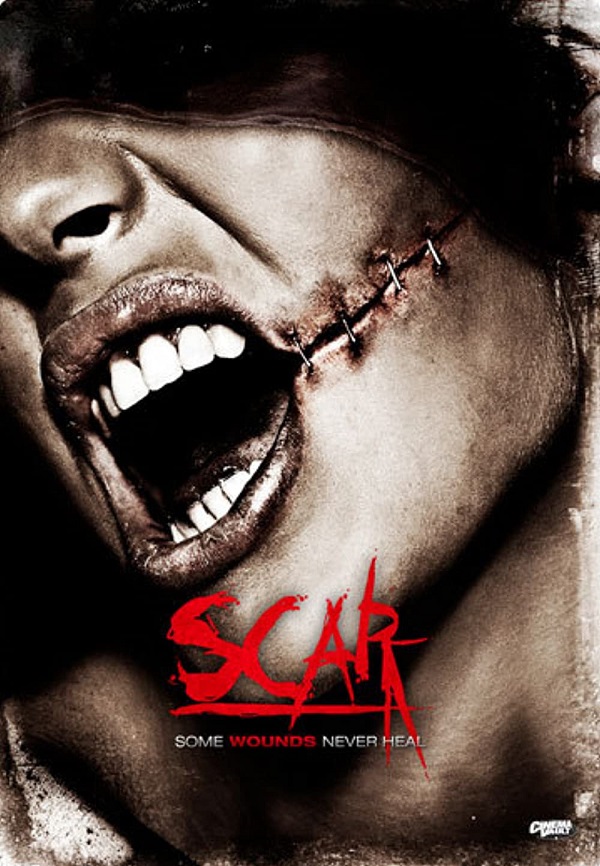 Scar 3D